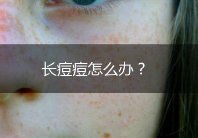 长痘痘怎么办？
