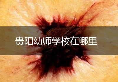 贵阳幼师学校在哪里