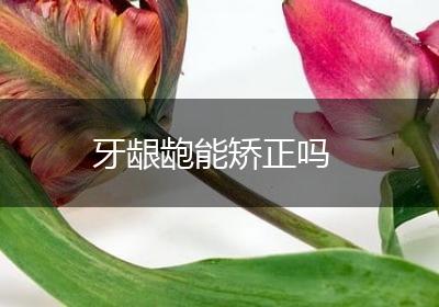 牙龈龅能矫正吗