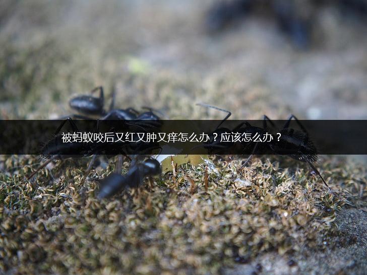 被蚂蚁咬后又红又肿又痒怎么办 应该怎么办？,第1张