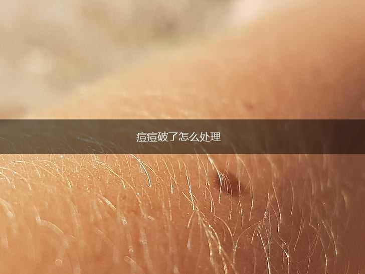 痘痘破了怎么处理,第1张