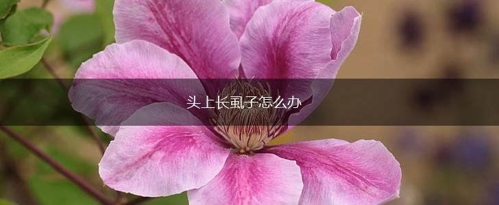 头上长虱子怎么办,第1张